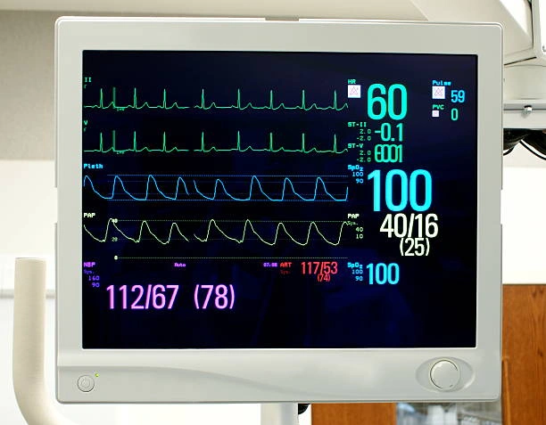 Monitor alfamed em Franca